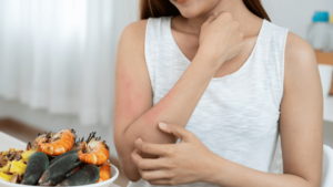 Does Properly Steaming Crabs Reduce Allergic Reactions?