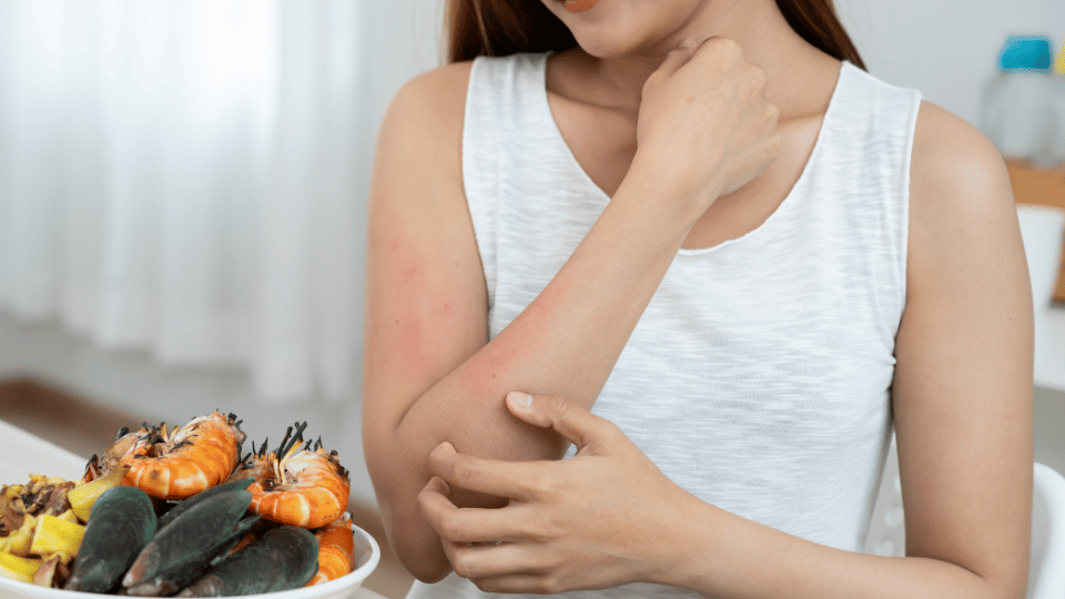 Does Properly Steaming Crabs Reduce Allergic Reactions?